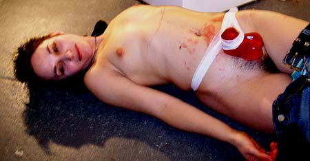 blood1